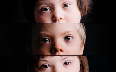 „cuDOWNe Dzieci” – wystawa fotografii Iwony Wilczek